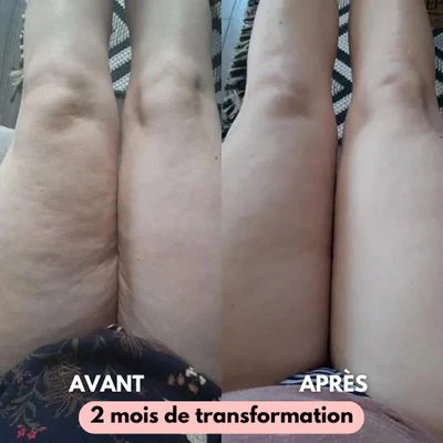 Avant/après Laura (36 ans)