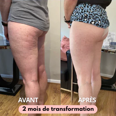 Avant/après Sophie (41 ans)